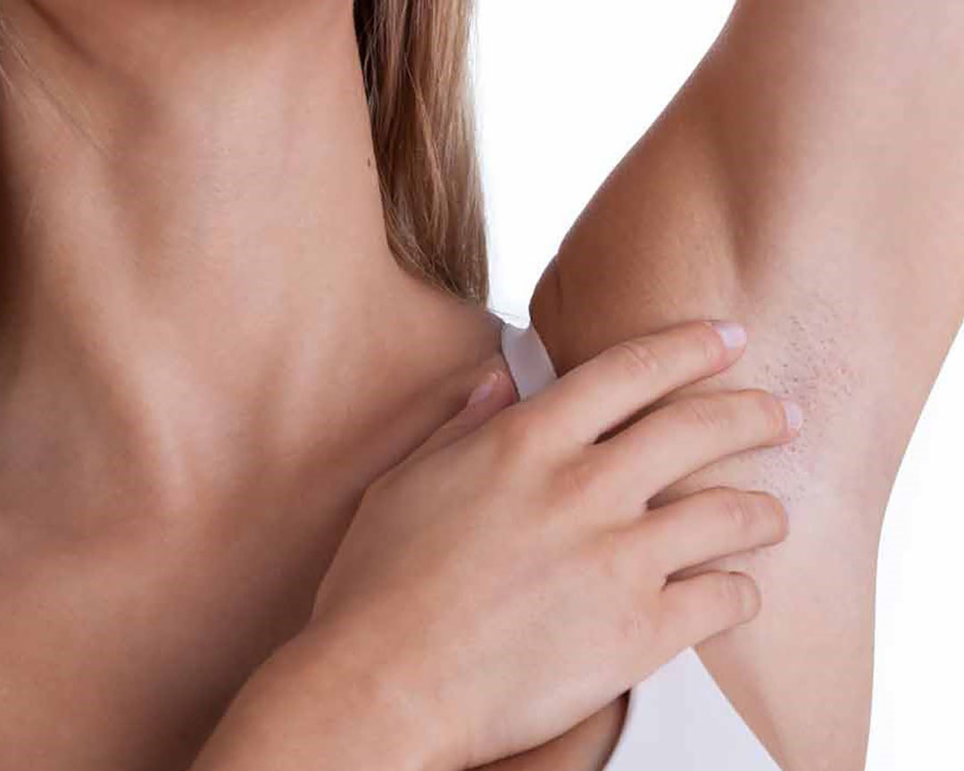 Breast Cancer Aftercare